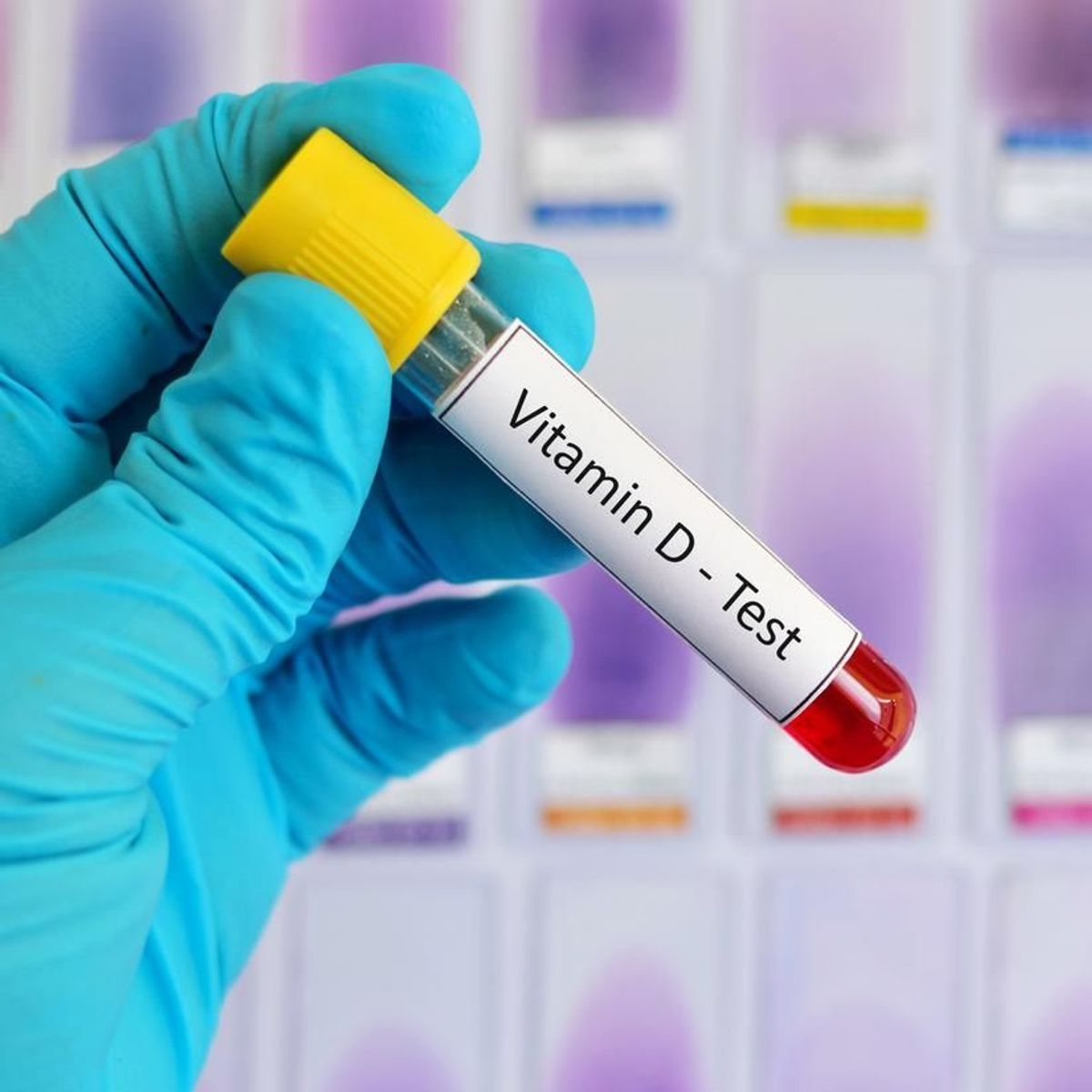 Dosage de 25hydroxyvitamine D définition, cause, symptômes, traitement