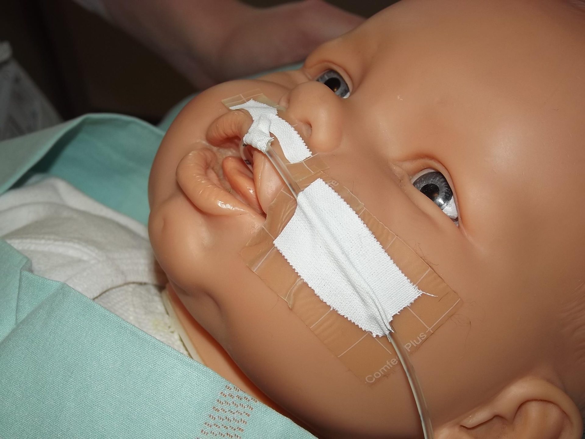 Insertion d'une sonde d'alimentation