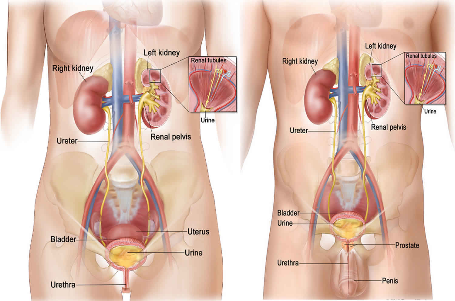 Uropathie obstructive