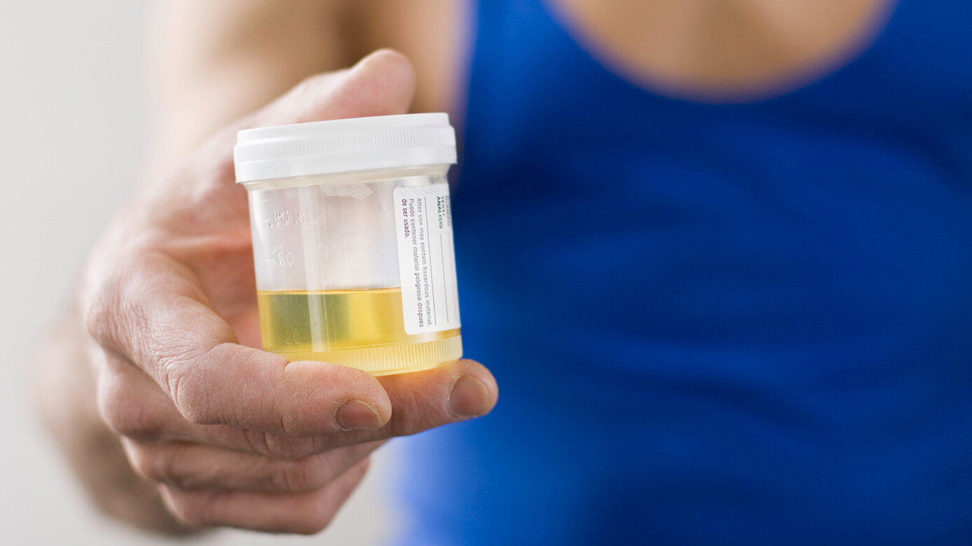 uréique dans l'urine